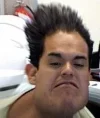 pelos.webp