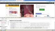 forobeta2.webp
