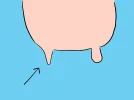 670px-Continue-until-deflated-10.webp