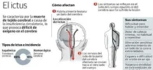 ictus.webp ictus.webp