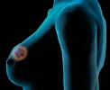 cancerdemama.webp