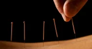acupuntura-2.webp acupuntura-2.webp