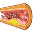 colesterol.webp