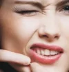 acne.webp acne.webp