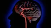 CEREBROVASCULARES.webp CEREBROVASCULARES.webp